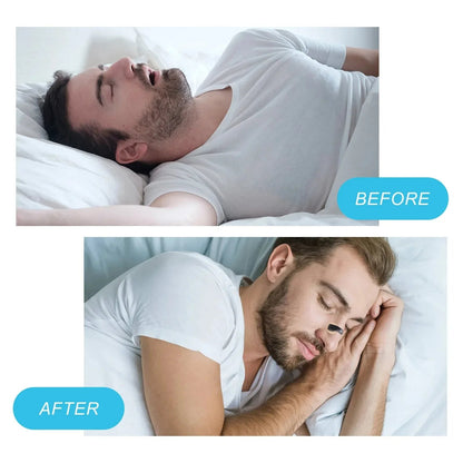 Magnetic Nasal Strips - Snoring Relief, Better Sleep, Nasal Congestion and Easy Breathing